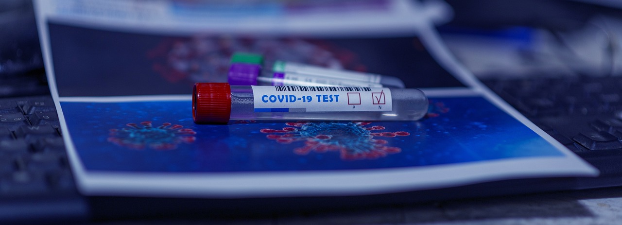 Covid 19 Test